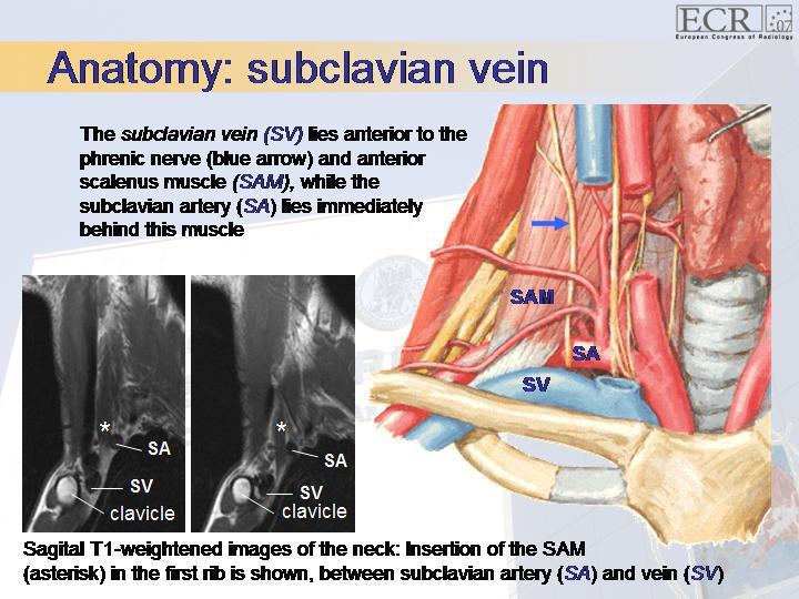 subclavian artery and vein