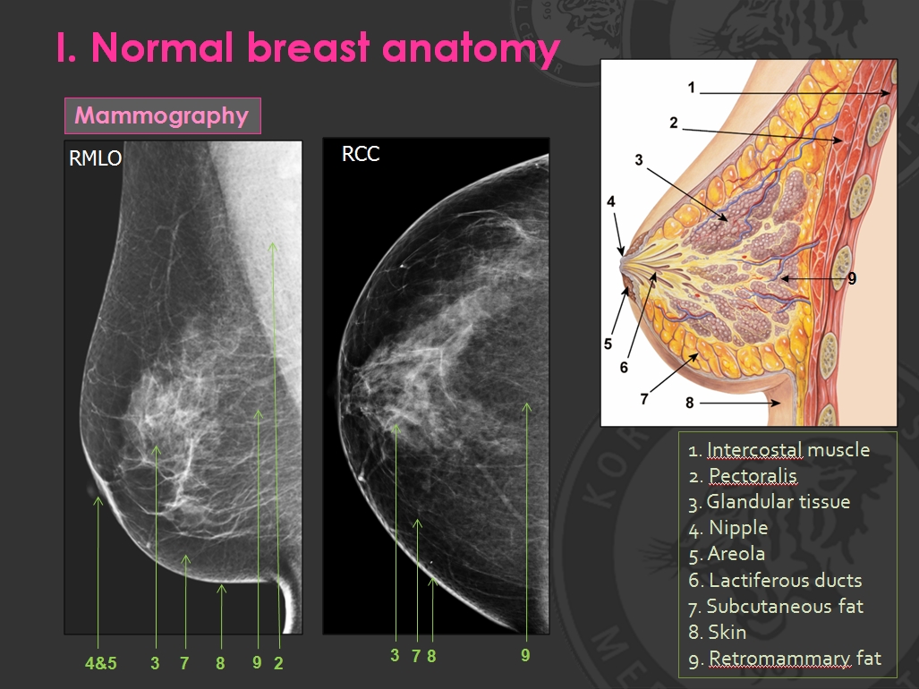 Breast Anatomy - Radiology