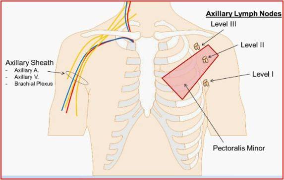 Three Anatomical Levels Of Axillary Lymph Nodes Level I Blue Lymph Download Scientific Diagram