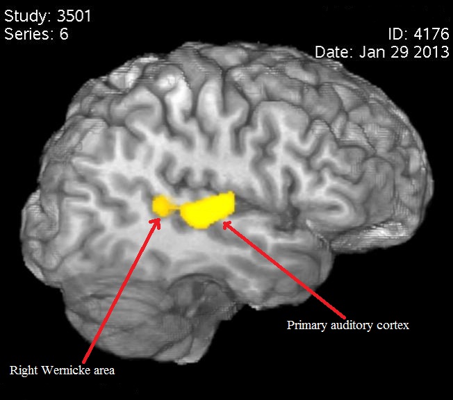 primary auditory cortex