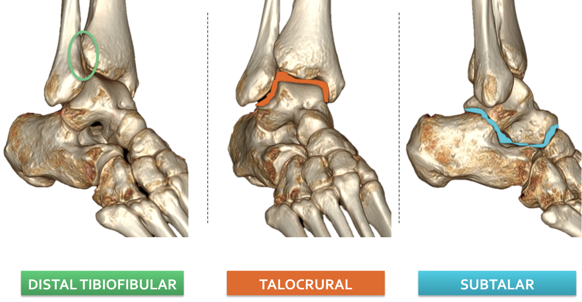 distal tibiofibular joint ankle