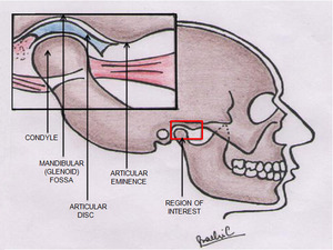 mandibular fossa
