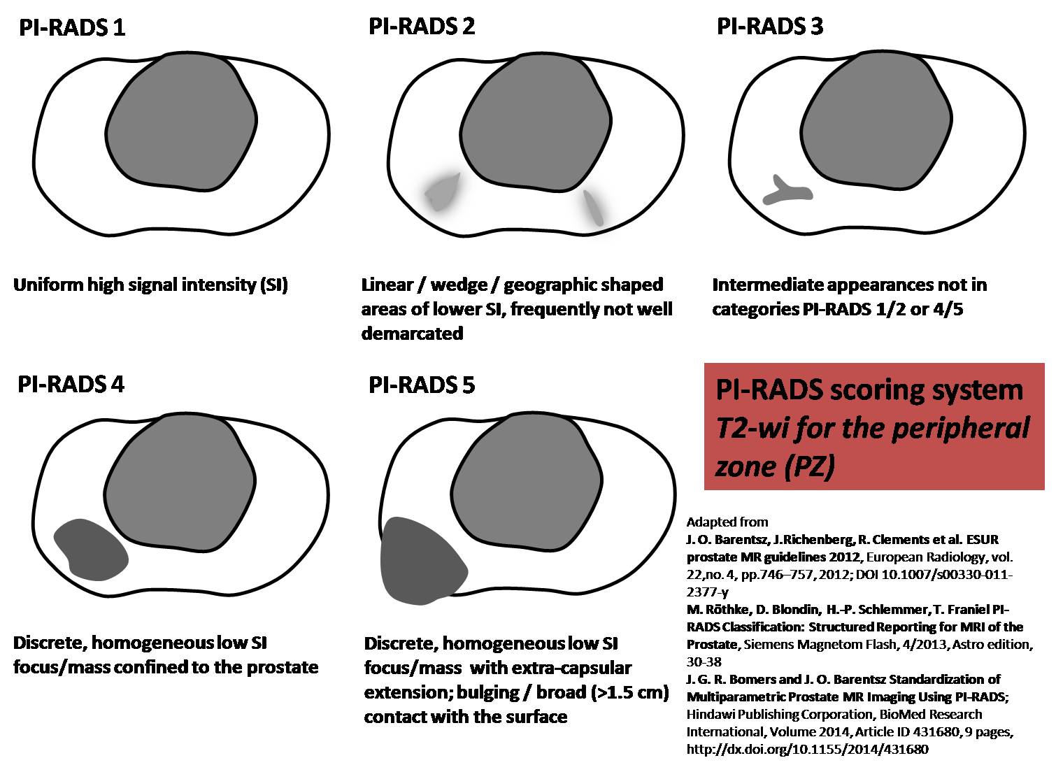 Pi rads предстательной железы что означает. Pirads 3 предстательной железы. Зоны предстательной железы на УЗИ. Предстательная железа кт анатомия. Анатомия предстательной железы на УЗИ.