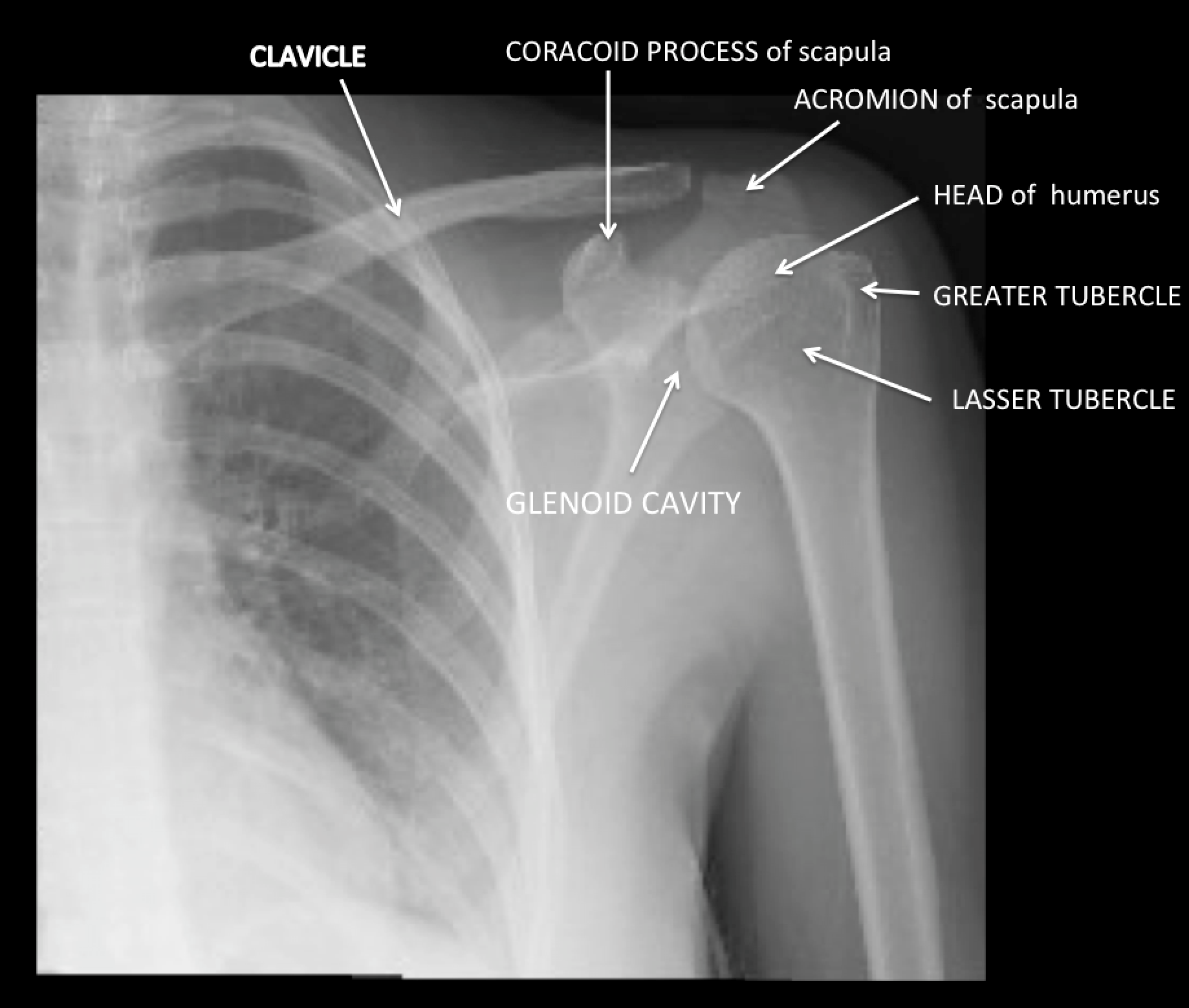 humerus anatomy x ray