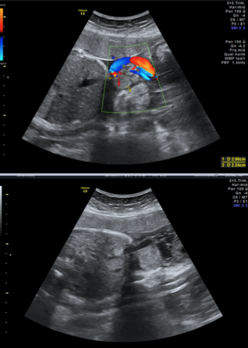Ultrasound second trimester Level 2