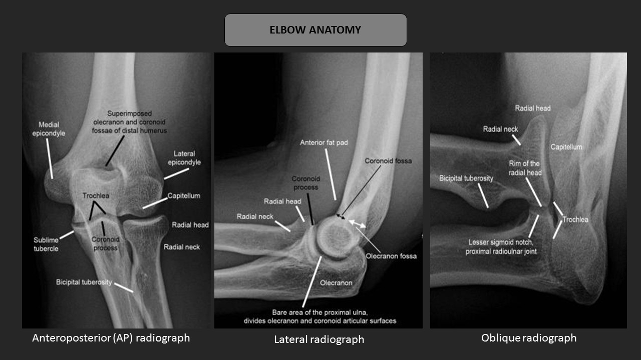 elbow anatomy xray