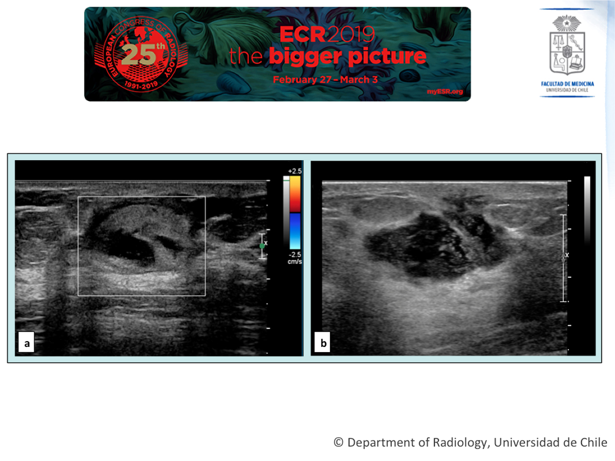 Grey scale imaging (ultrasound), Radiology Reference Article