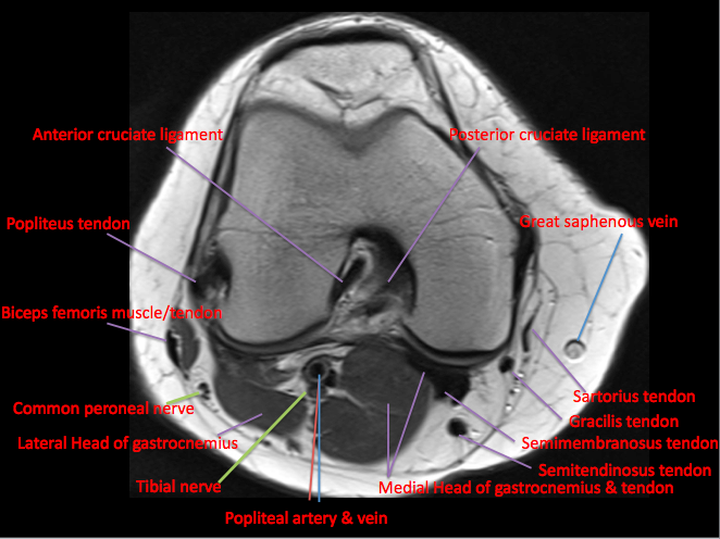 Knee Muscle Anatomy Mri : Atlas Of Knee Mri Anatomy W ...