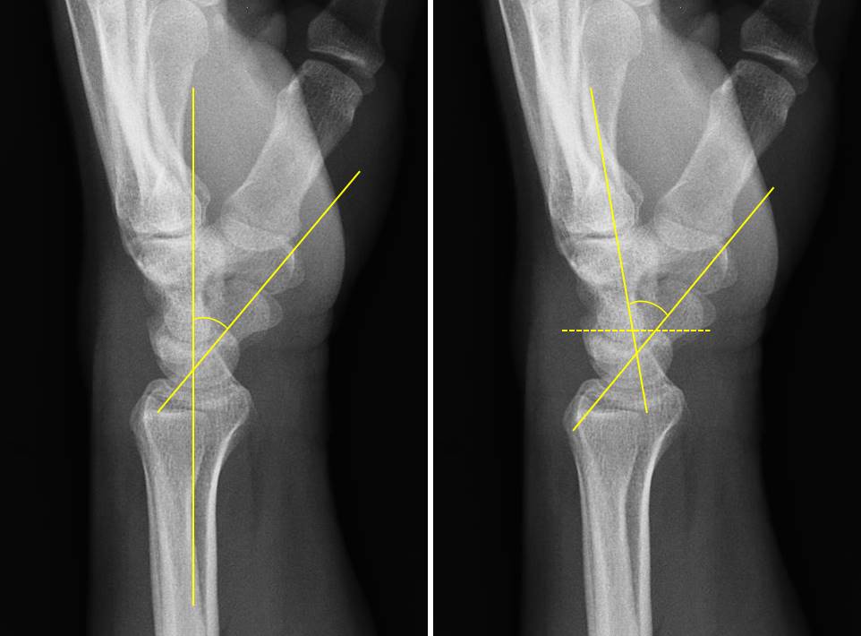 x ray wrist lateral view