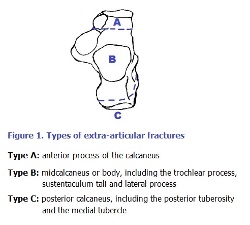 calcaneus fracture classification