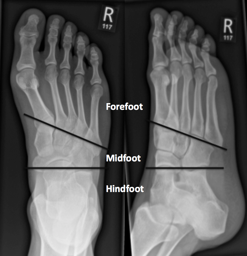 xray of normal foot