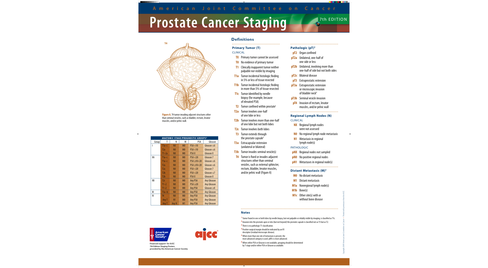 prostate cancer staging ajcc)