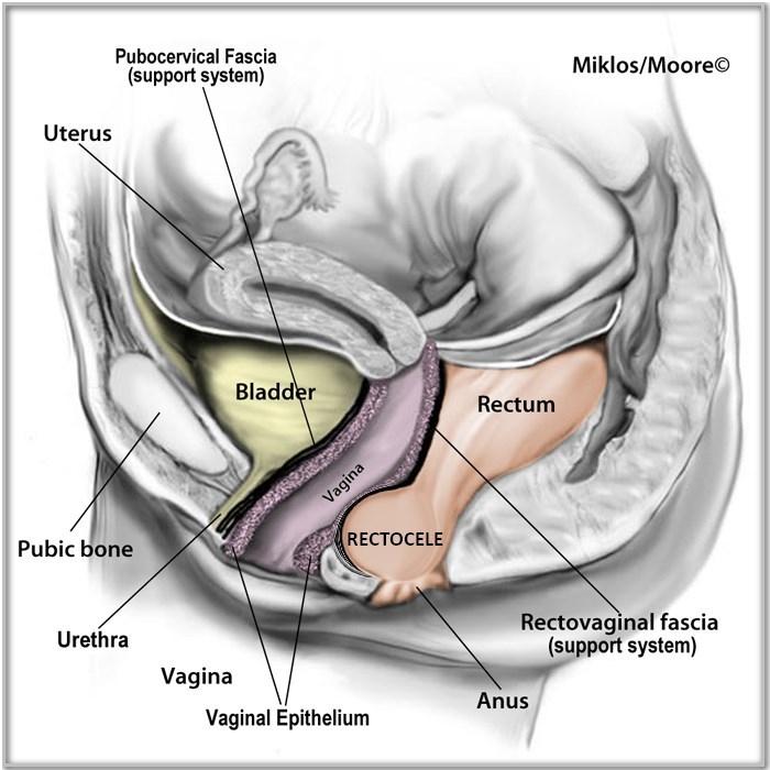 rectovaginal fascia