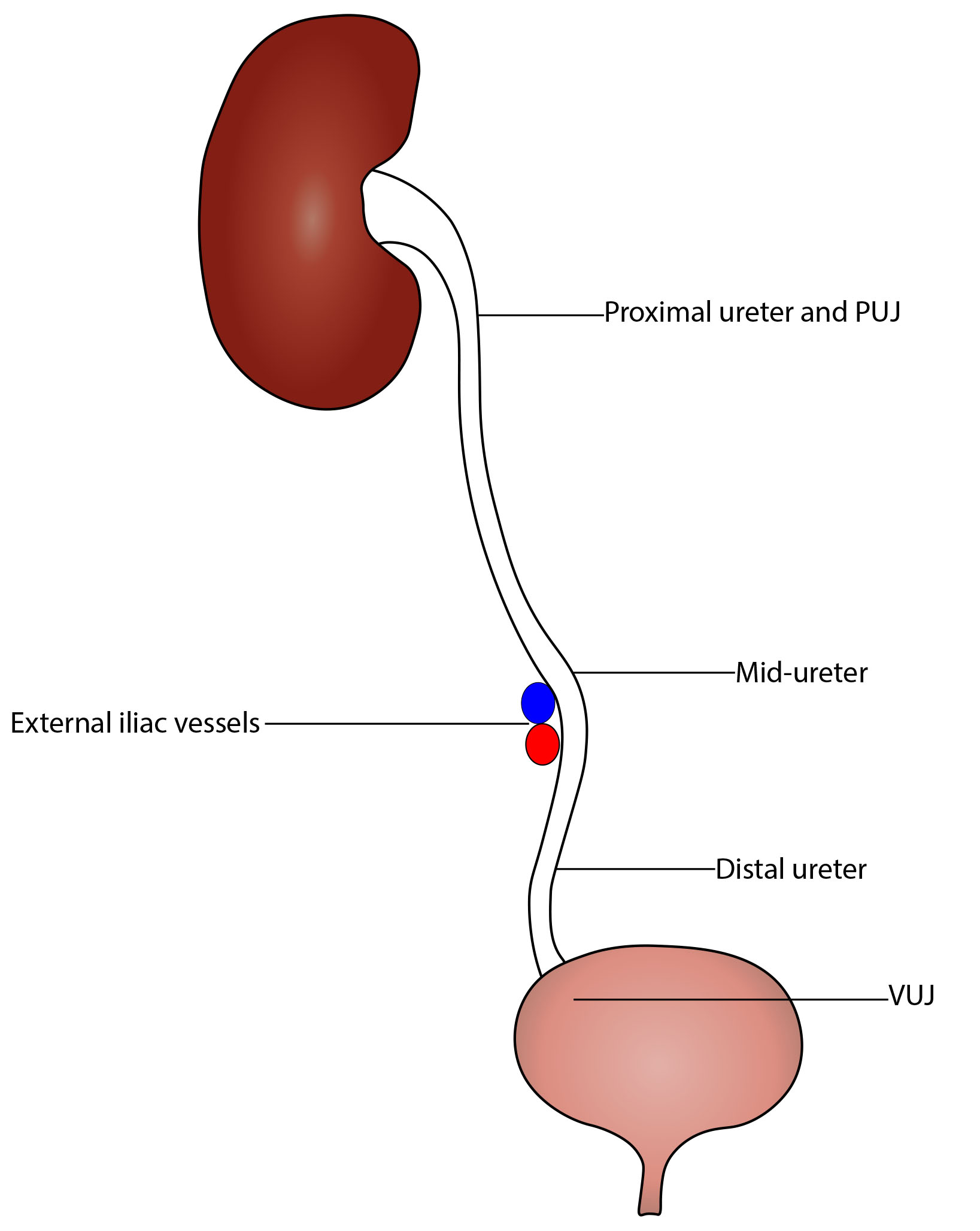 Right Ureteric Calculus Icd 10 Cm Code 2024 Icd - Renee Charline